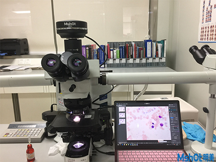 明美科研級攝像頭助力香港大學深圳醫(yī)院血液科骨髓切片觀察