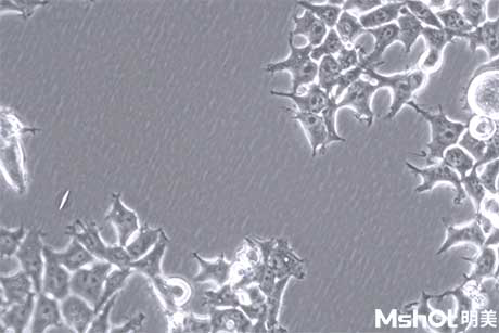 明美顯微鏡相機助力成都某生物股份公司食管鱗癌細胞檢測
