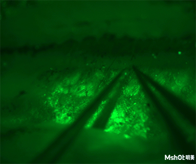 明美體視熒光顯微鏡助力深圳市第三人民醫(yī)院斑馬魚檢測
