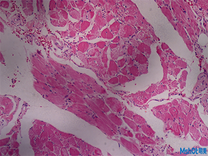 明美顯微鏡相機助力深圳某醫(yī)療科技生物試劑檢測
