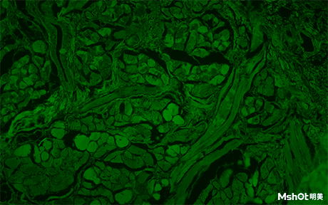 熒光顯微鏡在細菌篩查中的應用
