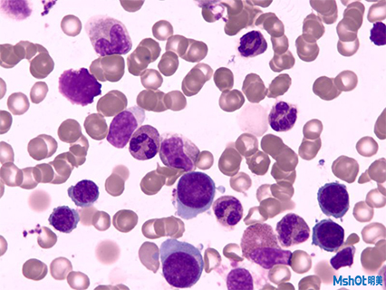 顯微鏡攝像頭應用于骨髓細胞觀察