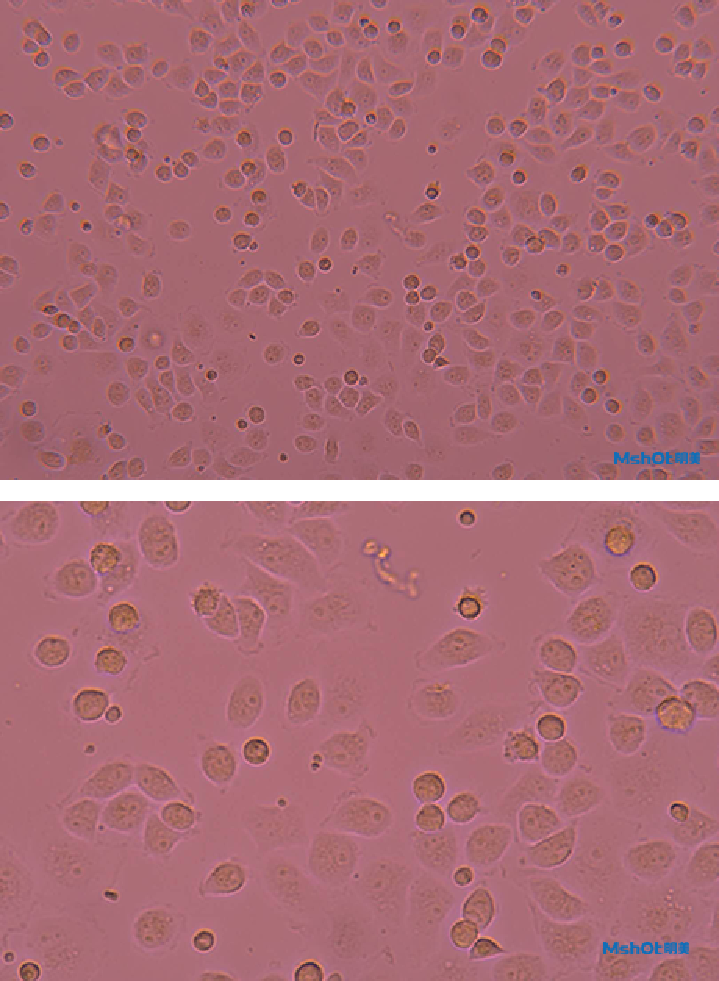 疫苗研發(fā)，就選明美熒光顯微鏡