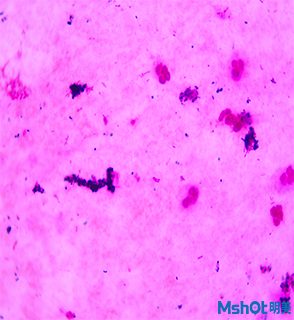 明美顯微鏡相機助力深圳市龍華中心醫(yī)院細菌觀察
