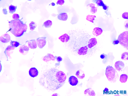 明美顯微鏡相機助力湘雅醫(yī)院骨髓檢測