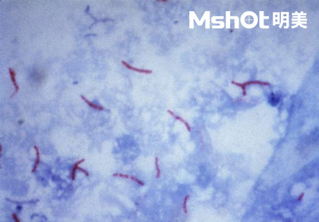 國產(chǎn)顯微鏡應用于結(jié)核桿菌檢測