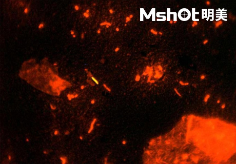 國產(chǎn)顯微鏡應(yīng)用于結(jié)核桿菌檢測