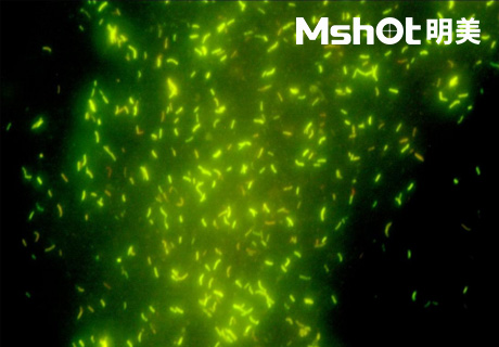 國產(chǎn)顯微鏡應(yīng)用于結(jié)核桿菌檢測