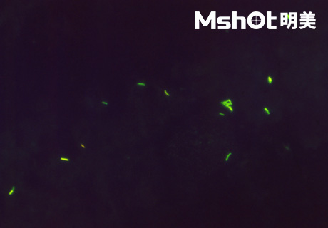 國產(chǎn)顯微鏡應(yīng)用于結(jié)核桿菌檢測