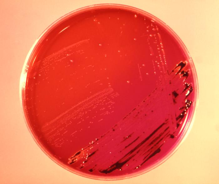 顯微鏡下的沙門氏菌|應用百科