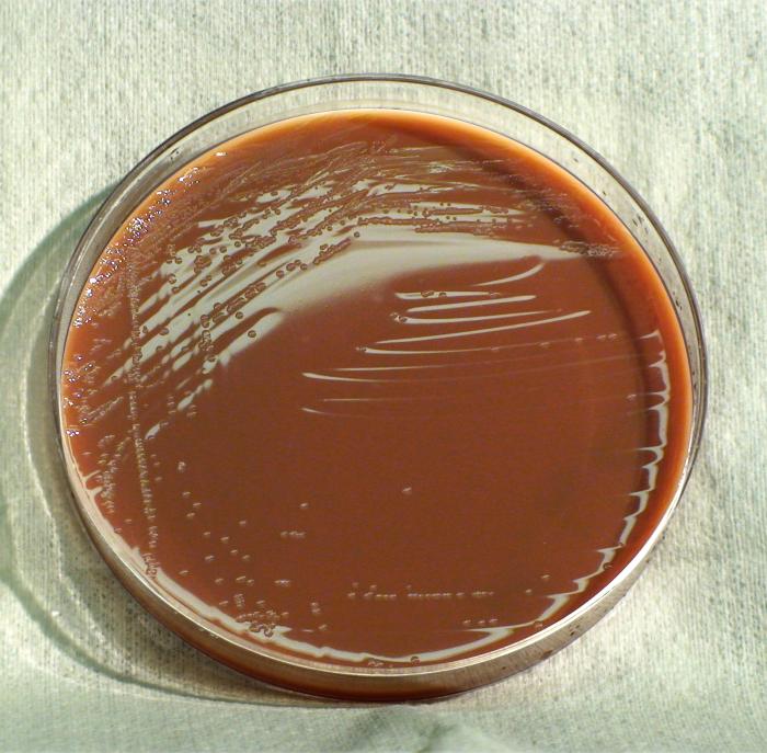 顯微鏡下的流感嗜血桿菌|應用百科