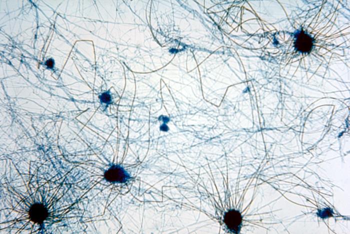 顯微鏡下的毛殼霉屬|(zhì)應用百科