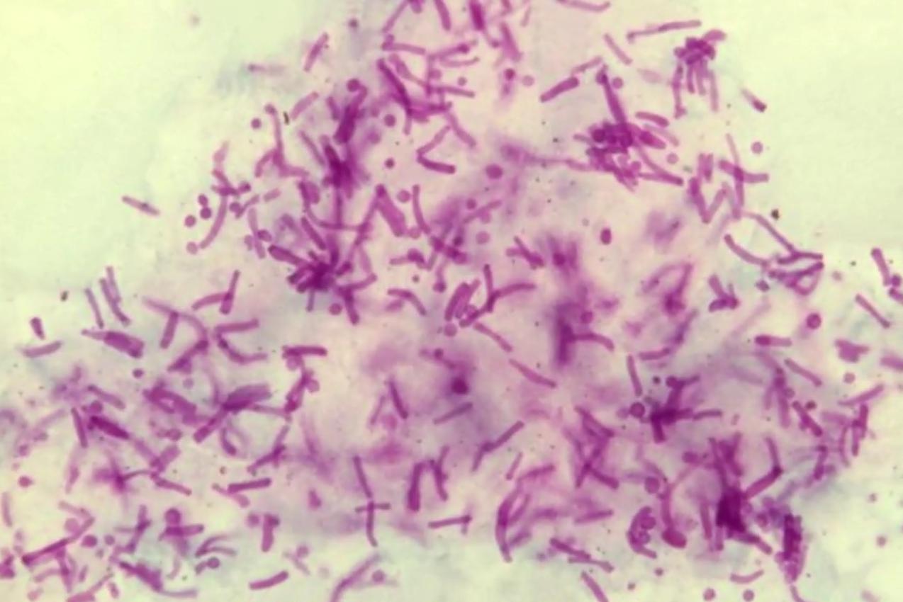 生物顯微鏡應用于馬色拉菌的研究|應用百科