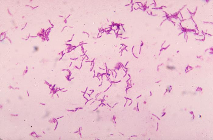 顯微鏡下的雙歧桿菌|應用百科