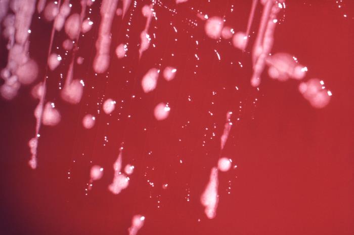 顯微鏡下的綠膿桿菌|應用百科