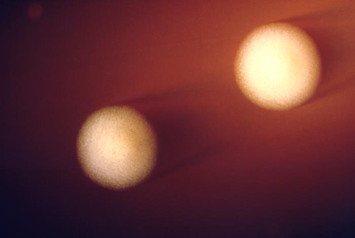 顯微鏡下的肉球桿菌|應用百科