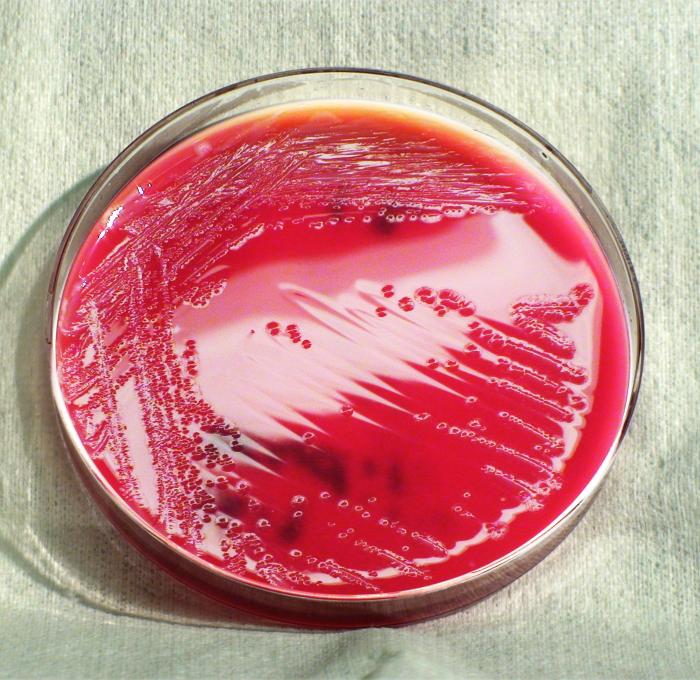 如何檢測痢疾桿菌？|應用百科