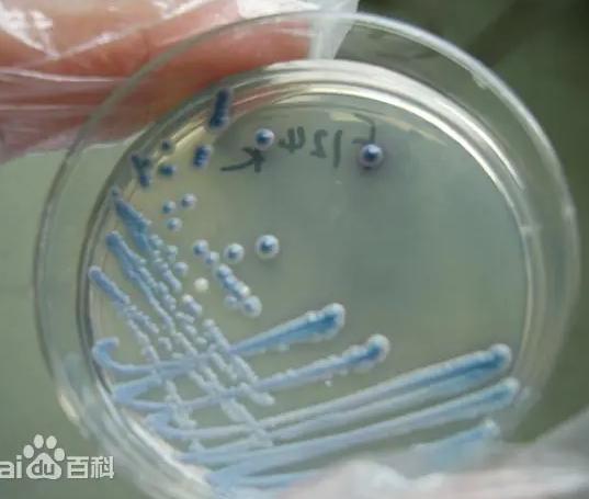 顯微鏡下的白假絲酵母菌|應用百科