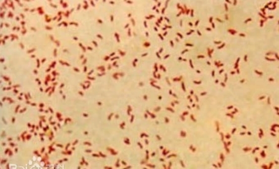 顯微鏡下的弧菌|應用百科