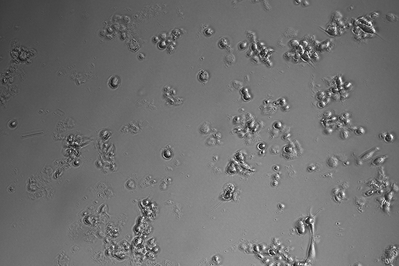 活細(xì)胞掃描分析儀拍攝圖