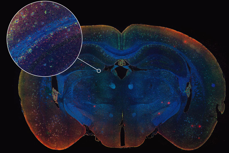 多重?zé)晒鈹?shù)字切片掃描系統(tǒng)拍攝圖