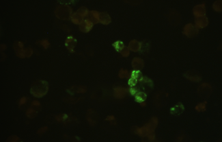 上呼吸道病毒(藍色激發(fā))