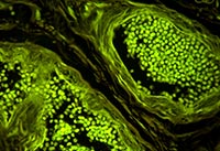 �{ɫ�ɹ�ģ�K�Ĕz�ğɹ��@΢�DƬ